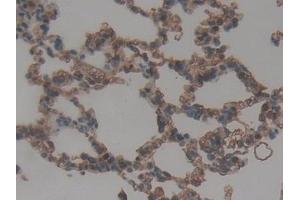 Detection of ITGaD in Rat Lung Tissue using Polyclonal Antibody to Integrin Alpha D (ITGaD)