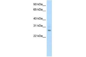WB Suggested Anti-ATF1 Antibody Titration:  0. (AFT1 antibody  (N-Term))