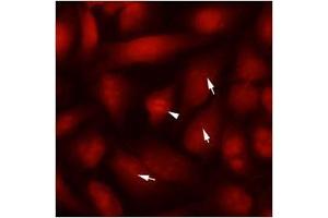 Immunofluorescenitrocellulosee of human SW480 cells stained with monoclonal anti-human TUBB2b antibody (1:250) with Texas Red (Red). (TUBB2B antibody  (AA 1-445))