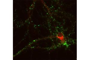 Immunofluorescence labeling of cultured hippocampus neurons (dilution 1 : 1000; red). (Neurobeachin antibody  (AA 952-1320))