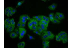 Immunofluorescence staining of HepG2 cells with ABIN7170247 at 1:133, counter-stained with DAPI. (SLC41A1 antibody  (AA 1-96))