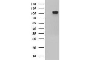 HEK293T cells were transfected with the pCMV6-ENTRY control (Left lane) or pCMV6-ENTRY USP5 (Right lane) cDNA for 48 hrs and lysed. (USP5 antibody)