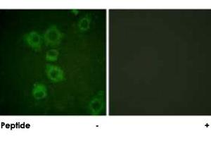 Immunofluorescence analysis of HUVEC cells, using CASP6 polyclonal antibody . (Caspase 6 antibody)