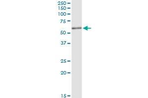 Immunoprecipitation of KIAA0368 transfected lysate using anti-KIAA0368 MaxPab rabbit polyclonal antibody and Protein A Magnetic Bead , and immunoblotted with KIAA0368 purified MaxPab mouse polyclonal antibody (B01P) . (ECM29 antibody  (AA 1-519))