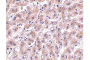 Immunohistochemistry of HTRA2 in human liver tissue with HTRA2 polyclonal antibody  at 2 ug/mL . (HTRA2 antibody  (C-Term))