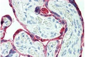 Human Placenta: Formalin-Fixed, Paraffin-Embedded (FFPE)