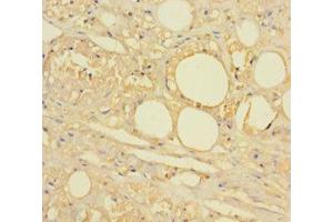 Immunohistochemistry of paraffin-embedded human skin tissue using HTR2A Antibody at dilution 1:100. (HTR2A antibody  (AA 385-471))