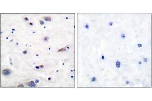 Immunohistochemistry analysis of paraffin-embedded human brain, using SHP-2 (Phospho-Tyr580) Antibody. (PTPN11 antibody  (pTyr580))