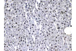 IHC analysis of VEGF Receptor 3 using anti-VEGF Receptor 3 antibody . (FLT4 antibody)