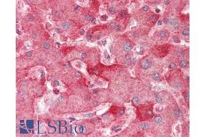 ABIN1590128 (5µg/ml) staining of paraffin embedded Human Liver. (ENPP2 antibody  (AA 698-712))