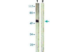 Western blot analysis of Lane 1: HepG2 cells, Lane 2: antigen-specific peptide treated HepG2 cells with ETS1 (phospho T38) polyclonal antibody  at 1:500-1:1000 dilution. (ETS1 antibody  (pThr38))