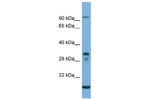 Host:  Rabbit  Target Name:  TM6SF2  Sample Type:  293T Whole cell lysates  Antibody Dilution:  1. (TM6SF2 antibody  (C-Term))