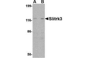 Western blot analysis of Slitrk3 in SK-N-SH cell lysate with AP30802PU-N Slitrk3 antibody at (A) 0. (SLITRK3 antibody  (C-Term))