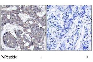 Image no. 1 for anti-Heat Shock 27kDa Protein 1 (HSPB1) (pSer82) antibody (ABIN197004) (HSP27 antibody  (pSer82))