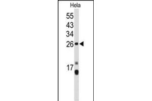 Western blot analysis of CENPH Antibody (Center) (ABIN653160 and ABIN2842728) in Hela cell line lysates (35 μg/lane). (CENPH antibody  (AA 136-162))