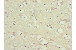 Immunohistochemistry (IHC) image for anti-NADH Dehydrogenase (Ubiquinone) 1 beta Subcomplex, 1, 7kDa (NDUFB1) (AA 1-172) antibody (ABIN7160914)