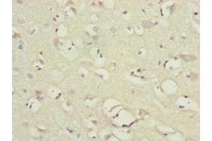 Immunohistochemistry of paraffin-embedded human brain tissue using ABIN7160914 at dilution of 1:100 (NDUFB1 antibody  (AA 1-172))
