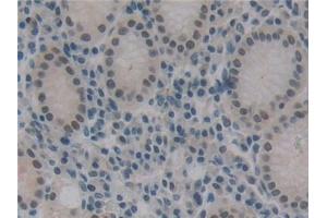 Immunohistochemistry (IHC) image for anti-DNA Fragmentation Factor, 45kDa, alpha Polypeptide (DFFA) (AA 51-305) antibody (ABIN7442849)