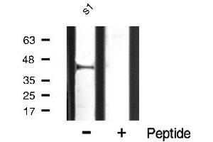 Western blot analysis of p38 MAPK expression in hela whole cell lysates,The lane on the right is treated with the antigen-specific peptide. (MAPK14 antibody)