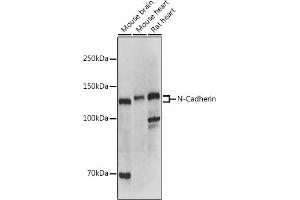 Western blot analysis of extracts of various cell lines, using N-Cadherin antibody (ABIN1684127, ABIN1514384, ABIN5663657 and ABIN6213846) at 1:500 dilution. (N-Cadherin antibody  (AA 450-550))