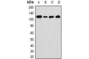 Western blot analysis of ANKRD28 expression in Hela (A), HT1080 (B), mouse kidney (C), mouse testis (D) whole cell lysates.