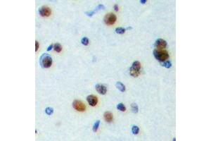 Immunohistochemical analysis of NPAS4 staining in human brain formalin fixed paraffin embedded tissue section. (NPAS4 antibody  (C-Term))