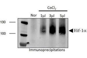 Image no. 5 for anti-Hypoxia Inducible Factor 1, alpha Subunit (Basic Helix-Loop-Helix Transcription Factor) (HIF1A) (AA 432-528) antibody (ABIN363317) (HIF1A antibody  (AA 432-528))