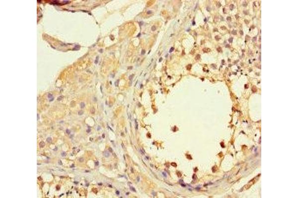 LTV1 antibody  (AA 201-475)