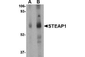 Western Blotting (WB) image for anti-Six Transmembrane Epithelial Antigen of The Prostate 1 (STEAP1) (Middle Region) antibody (ABIN1031108) (STEAP1 antibody  (Middle Region))