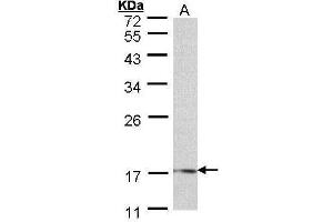 WB Image Sample (30 ug of whole cell lysate) A: 293T 12% SDS PAGE antibody diluted at 1:500 (LMO1 antibody)
