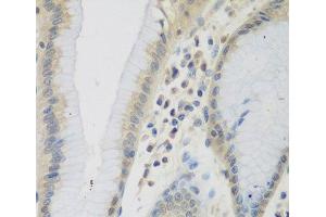 Immunohistochemistry of paraffin-embedded Human stomach using CCL26 Polyclonal Antibody at dilution of 1:200 (40x lens). (CCL26 antibody)
