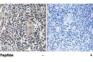 Immunohistochemical analysis of paraffin-embedded human thymus gland tissue using STMN1 polyclonal antibody . (Stathmin 1 antibody  (Ser15))