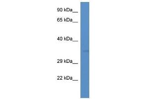 Western Blot showing Tmem110 antibody used at a concentration of 1. (TMEM110 antibody  (C-Term))