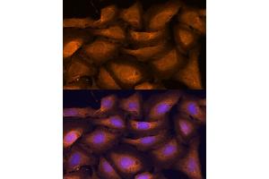Immunofluorescence analysis of U-2 OS cells using  antibody (ABIN7265407) at dilution of 1:100. (ATF5 antibody)