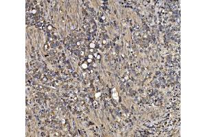 IHC analysis of ATG9A using anti-ATG9A antibody (ABIN7600676).
