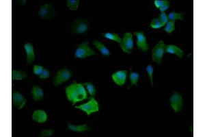 Immunofluorescence staining of MCF-7 cells with ABIN7151584 at 1:200, counter-stained with DAPI. (ELP4 antibody  (AA 117-223))