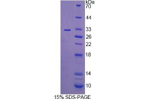 Image no. 1 for C-Mer Proto-Oncogene Tyrosine Kinase (MERTK) (AA 587-858) protein (His tag) (ABIN4990204) (MERTK Protein (AA 587-858) (His tag))