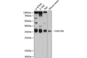 Western blot analysis of extracts of various cell lines, using CD301/CLEC10A antibody (ABIN6130073, ABIN6138696, ABIN6138697 and ABIN6215492) at 1:1000 dilution. (CLEC10A antibody  (AA 60-180))