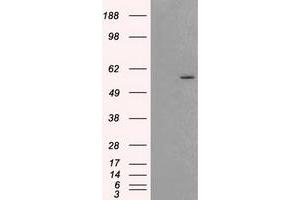 HEK293T cells were transfected with the pCMV6-ENTRY control (Left lane) or pCMV6-ENTRY AKT2 (Right lane) cDNA for 48 hrs and lysed. (AKT2 antibody)