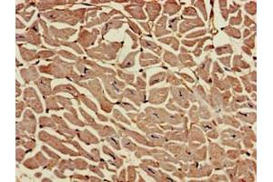 Immunohistochemistry of paraffin-embedded human heart tissue using ABIN7167819 at dilution of 1:100 (RAI1 antibody  (AA 617-823))