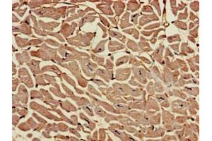Immunohistochemistry of paraffin-embedded human heart tissue using ABIN7167819 at dilution of 1:100 (RAI1 antibody  (AA 617-823))