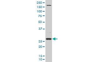 DCUN1D1 polyclonal antibody (A01), Lot # 060524JCS1 Western Blot analysis of DCUN1D1 expression in Hela S3 NE . (DCUN1D1 antibody  (AA 1-89))