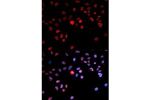 Immunofluorescence analysis of MCF7 cell using Phospho-CREB1-S133 antibody. (CREB1 antibody  (pSer133))