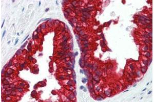 Human Prostate (formalin-fixed, paraffin-embedded) stained with SP3 antibody ABIN462188 followed by biotinylated goat anti-rabbit IgG secondary antibody ABIN481713, alkaline phosphatase-streptavidin and chromogen. (Sp3 antibody  (AA 287-336))