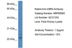 WB Suggested Anti-CBR4  Antibody Titration: 0. (CBR4 antibody  (N-Term))
