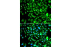 Immunofluorescence analysis of  cells using CSRP2BP antibody (ABIN6127664, ABIN6139138, ABIN6139139 and ABIN6223242). (CSRP2BP antibody  (AA 523-782))