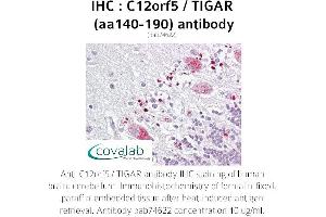 Image no. 1 for anti-TP53 induced glycolysis regulatory phosphatase (TIGAR) (AA 140-190) antibody (ABIN1732472) (TIGAR antibody  (AA 140-190))