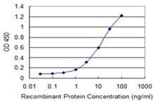Detection limit for recombinant GST tagged RNF133 is 0. (RNF133 antibody  (AA 277-376))