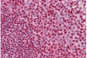 Human Spleen: Formalin-Fixed, Paraffin-Embedded (FFPE) (CUX1 antibody  (AA 521-621))