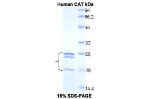 SDS-PAGE (SDS) image for Catalase (CAT) (AA 401-523) protein (His tag) (ABIN1079138)